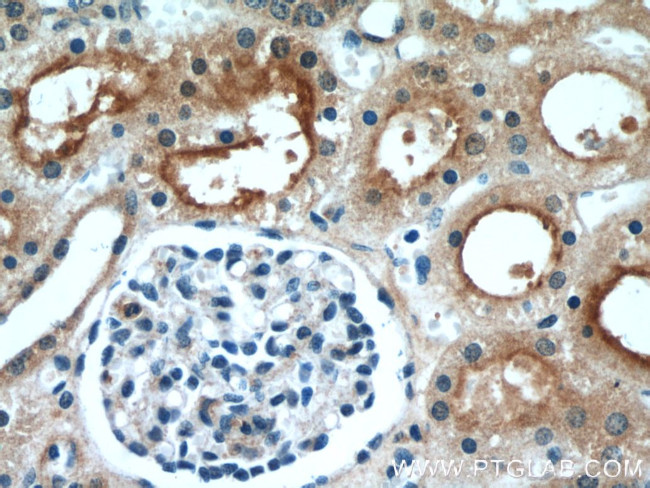 LNPEP Antibody in Immunohistochemistry (Paraffin) (IHC (P))