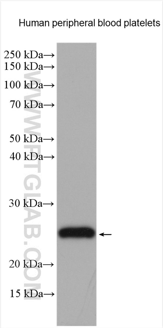 CD42c Antibody in Western Blot (WB)