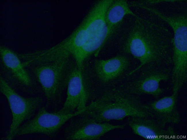 PPP3CC Antibody in Immunocytochemistry (ICC/IF)