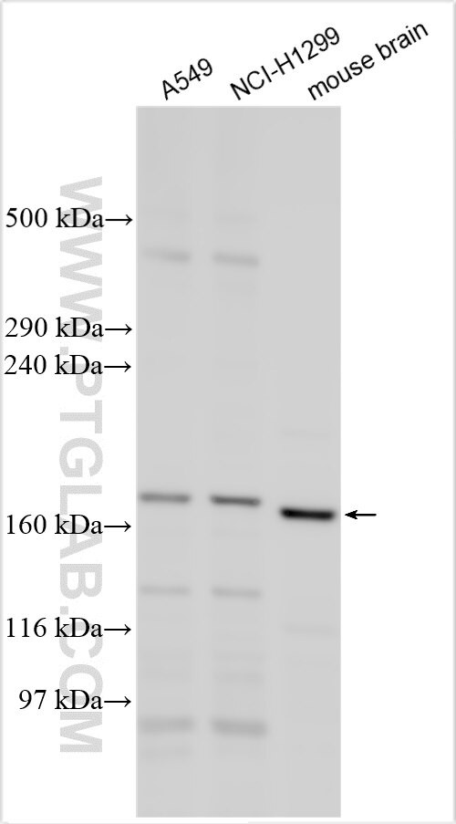 SUR1 Antibody in Western Blot (WB)