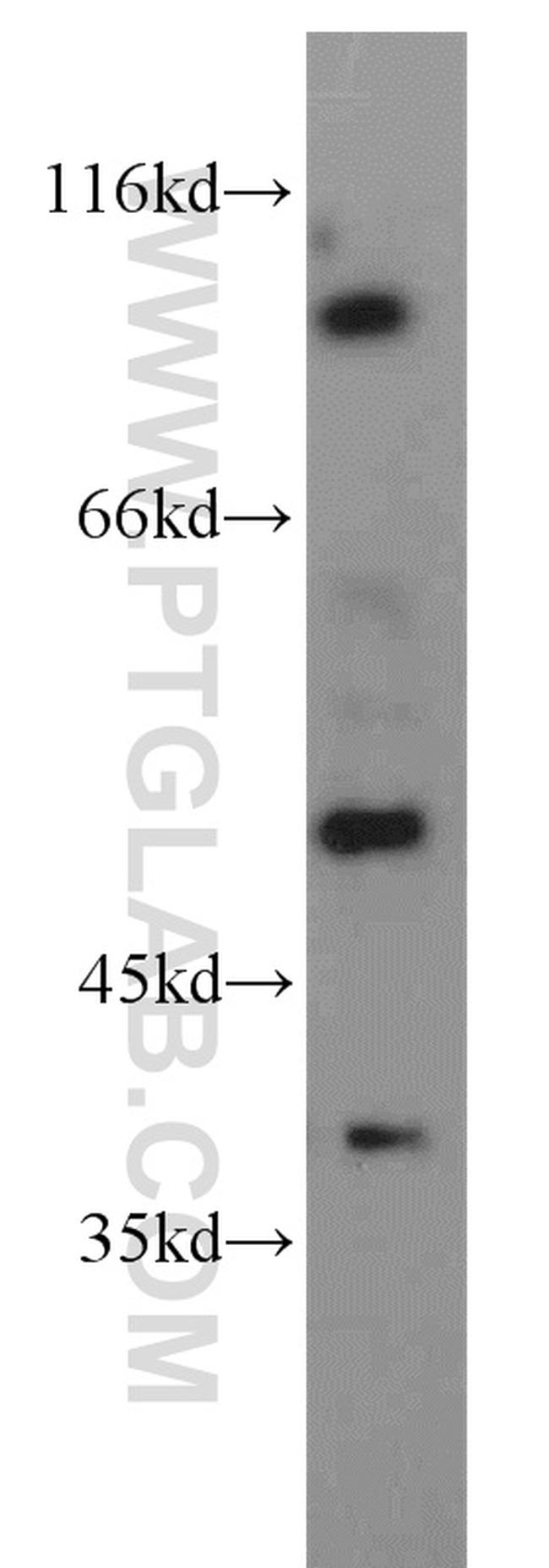 PDE6C Antibody in Western Blot (WB)