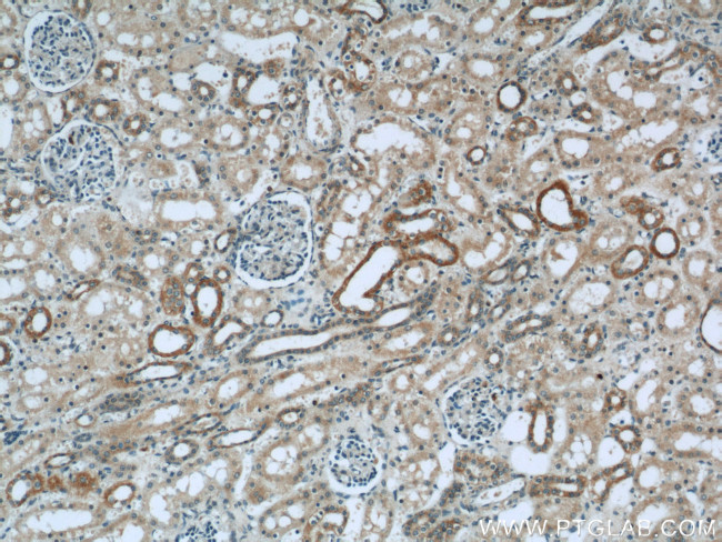 OXER1 Antibody in Immunohistochemistry (Paraffin) (IHC (P))