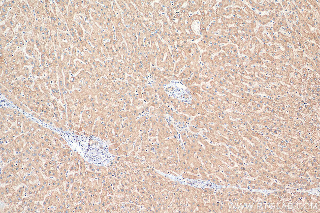 ACADM Antibody in Immunohistochemistry (Paraffin) (IHC (P))