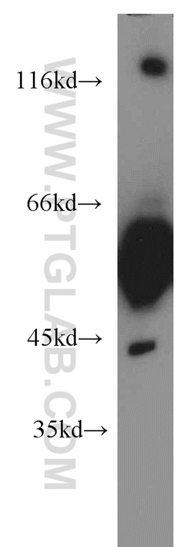 GDI1 Antibody in Western Blot (WB)