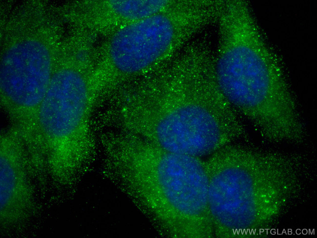 CYP8B1 Antibody in Immunocytochemistry (ICC/IF)