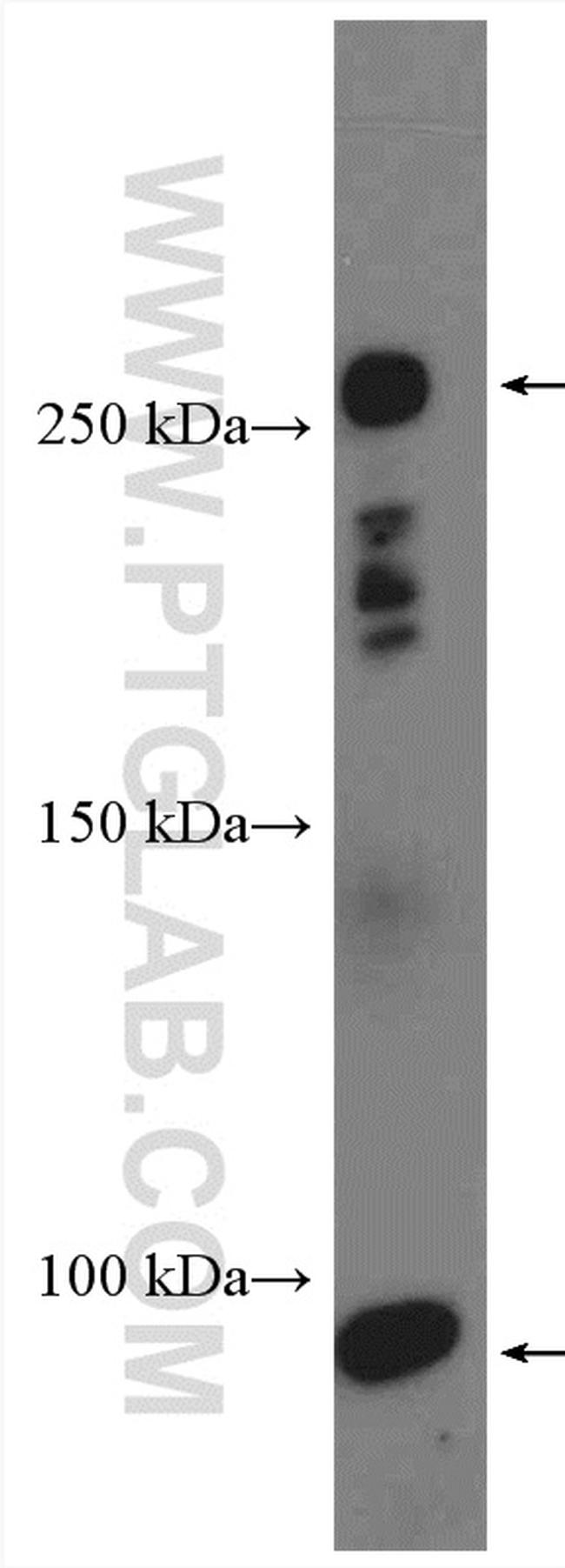 C4-B alpha chain/C4b-B/C4d-B Antibody in Western Blot (WB)