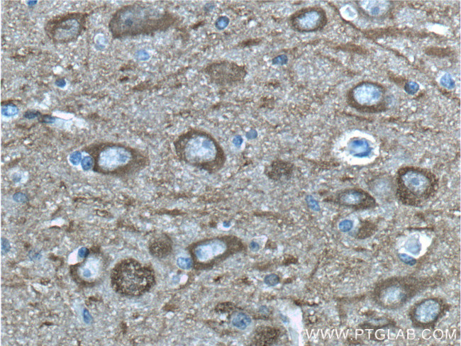 NSE/ENO2 Antibody in Immunohistochemistry (Paraffin) (IHC (P))