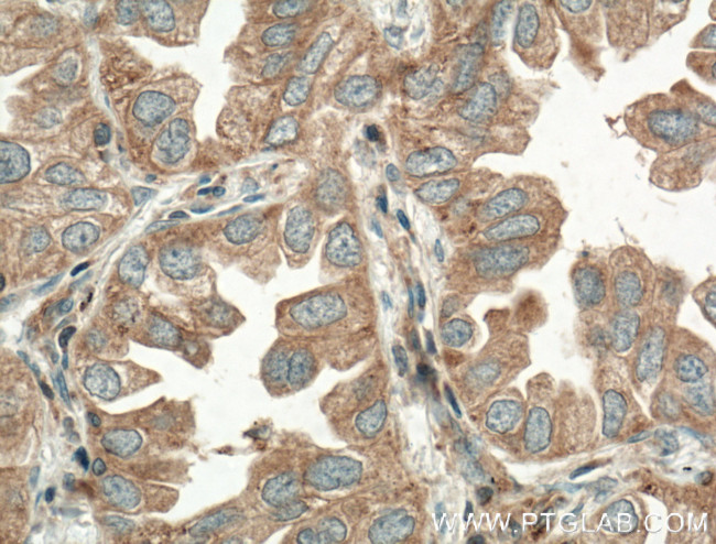TPSD1 Antibody in Immunohistochemistry (Paraffin) (IHC (P))
