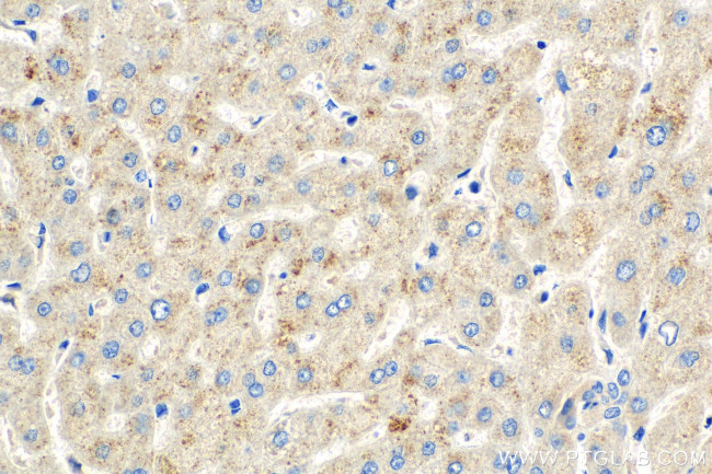 MASP2 Antibody in Immunohistochemistry (Paraffin) (IHC (P))
