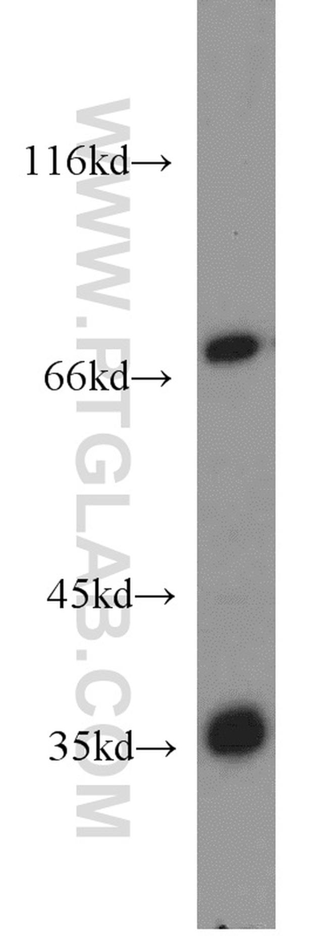 RCBTB1 Antibody in Western Blot (WB)