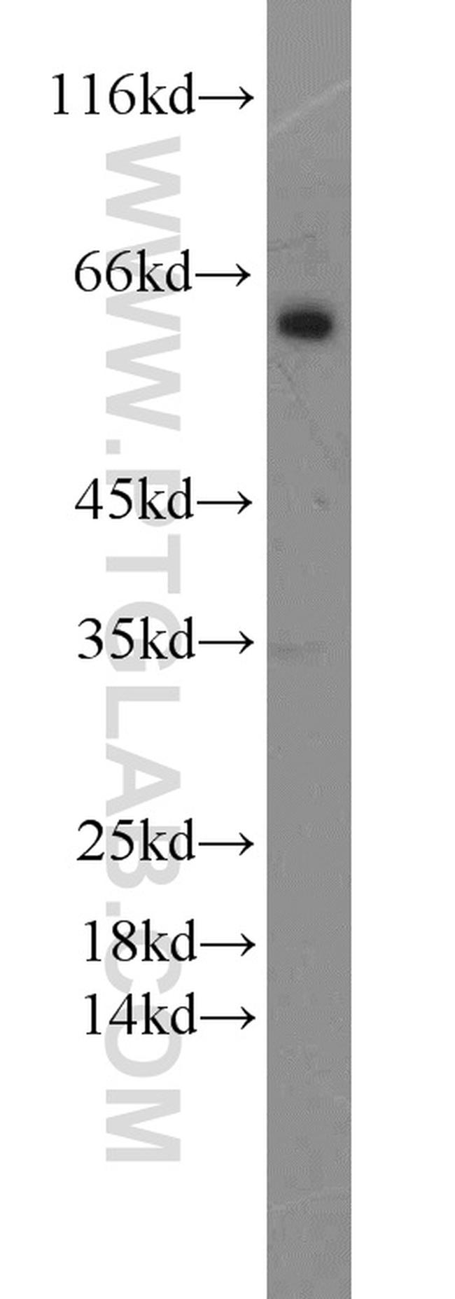 MAOB Antibody in Western Blot (WB)