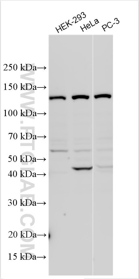DRAM Antibody in Western Blot (WB)