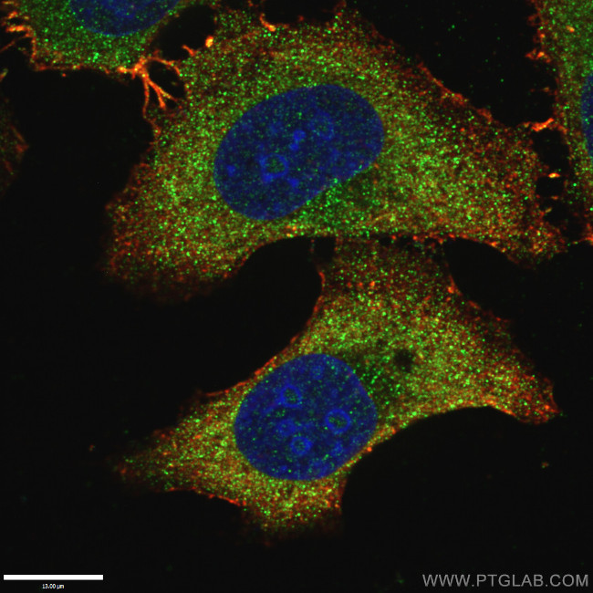 LAMP1 Antibody in Immunocytochemistry (ICC/IF)