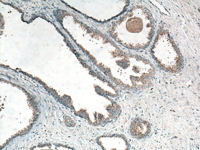 CTAGE5 Antibody in Immunohistochemistry (Paraffin) (IHC (P))