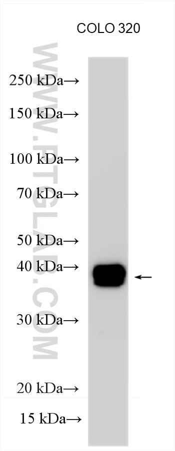 FKBP15 Antibody in Western Blot (WB)