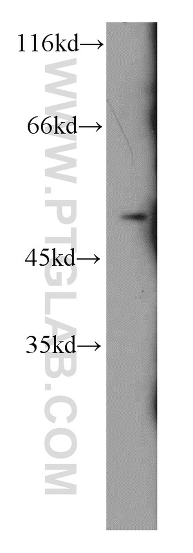 CHRNA10 Antibody in Western Blot (WB)