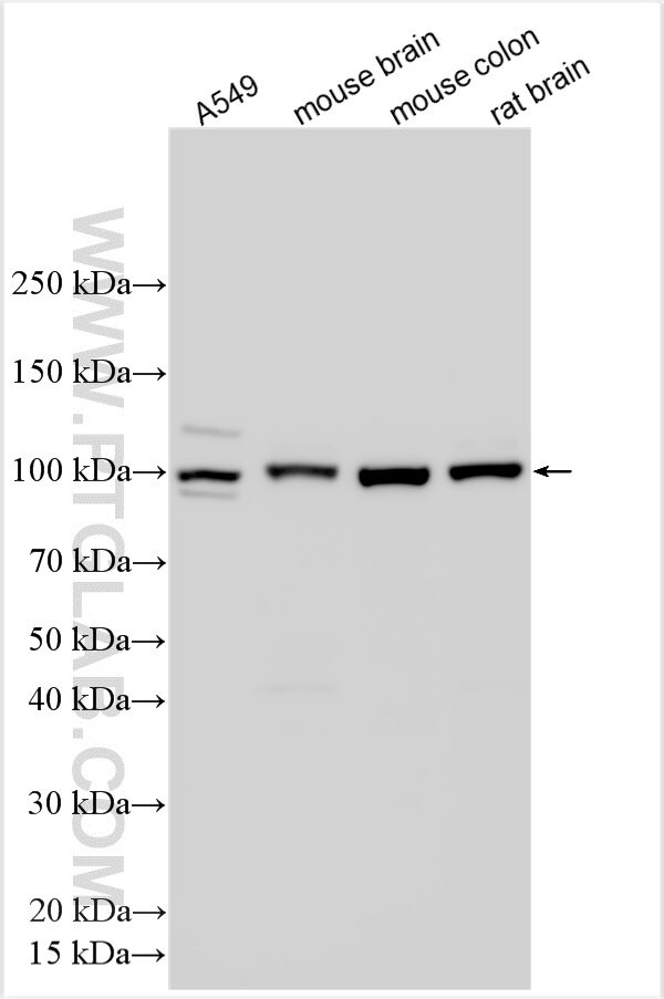 RANK/TNFRSF11A Antibody in Western Blot (WB)
