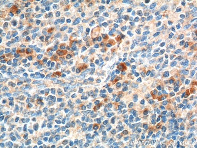 HTR1A Antibody in Immunohistochemistry (Paraffin) (IHC (P))