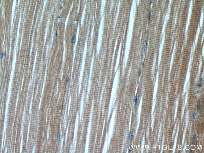 PAMR1 Antibody in Immunohistochemistry (Paraffin) (IHC (P))