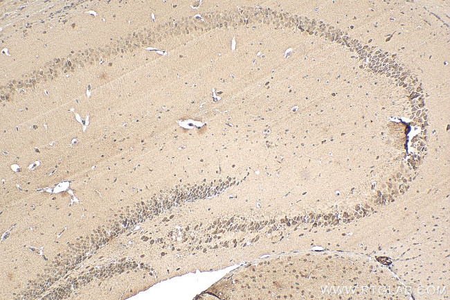 MYO5A Antibody in Immunohistochemistry (Paraffin) (IHC (P))