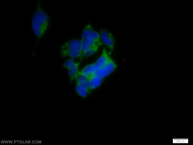 SH2D5 Antibody in Immunocytochemistry (ICC/IF)