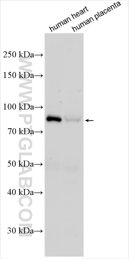 MTIF2 Antibody in Western Blot (WB)