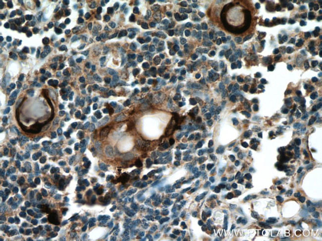 Involucrin Antibody in Immunohistochemistry (Paraffin) (IHC (P))