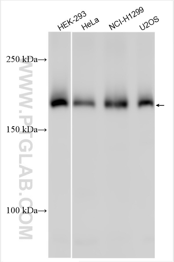 CLCN3 Antibody in Western Blot (WB)