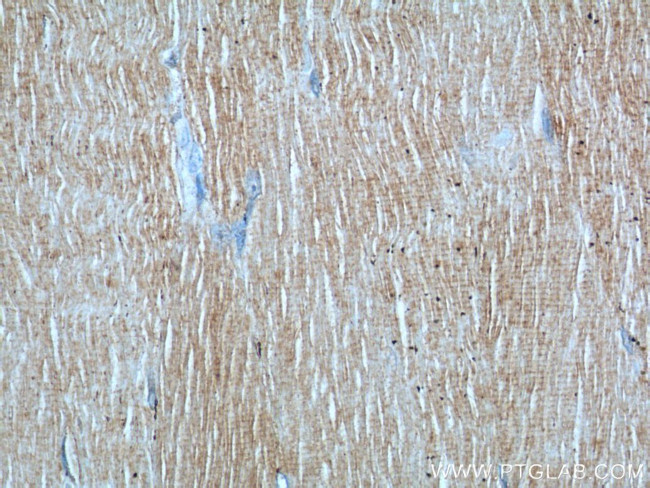SEPN1 Antibody in Immunohistochemistry (Paraffin) (IHC (P))