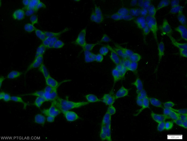 STK38 Antibody in Immunocytochemistry (ICC/IF)
