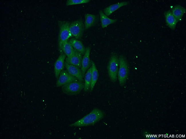 RNASE3 Antibody in Immunocytochemistry (ICC/IF)