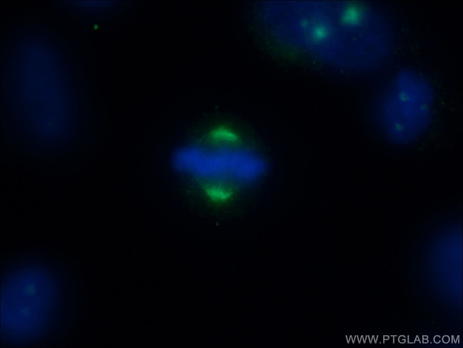 CEP78 Antibody in Immunocytochemistry (ICC/IF)