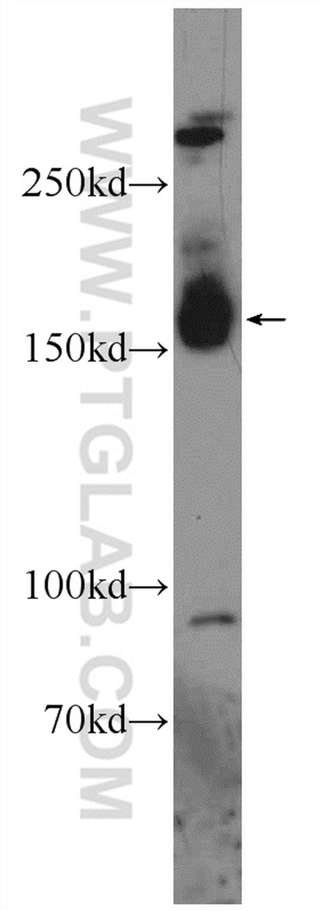 JMJD3 Antibody in Western Blot (WB)
