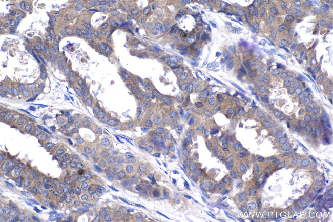 FGFR3 Antibody in Immunohistochemistry (Paraffin) (IHC (P))