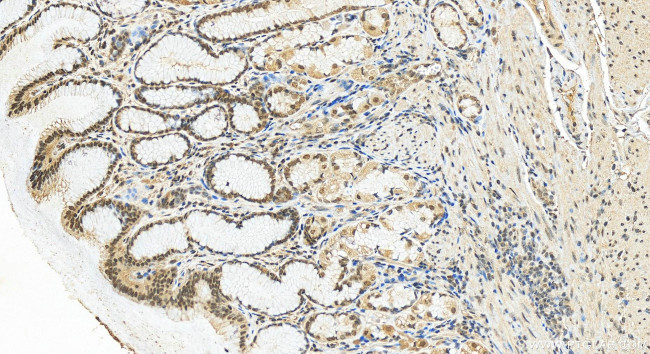 PRDM16 Antibody in Immunohistochemistry (Paraffin) (IHC (P))