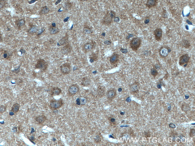 p140Cap Antibody in Immunohistochemistry (Paraffin) (IHC (P))