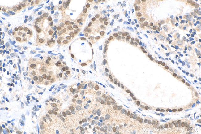 FOXE1 Antibody in Immunohistochemistry (Paraffin) (IHC (P))