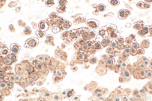 EVC2 Antibody in Immunohistochemistry (Paraffin) (IHC (P))