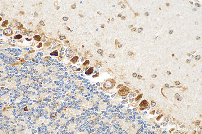 SKOR2 Antibody in Immunohistochemistry (Paraffin) (IHC (P))