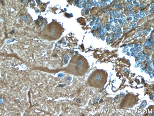 GJC2 Antibody in Immunohistochemistry (Paraffin) (IHC (P))