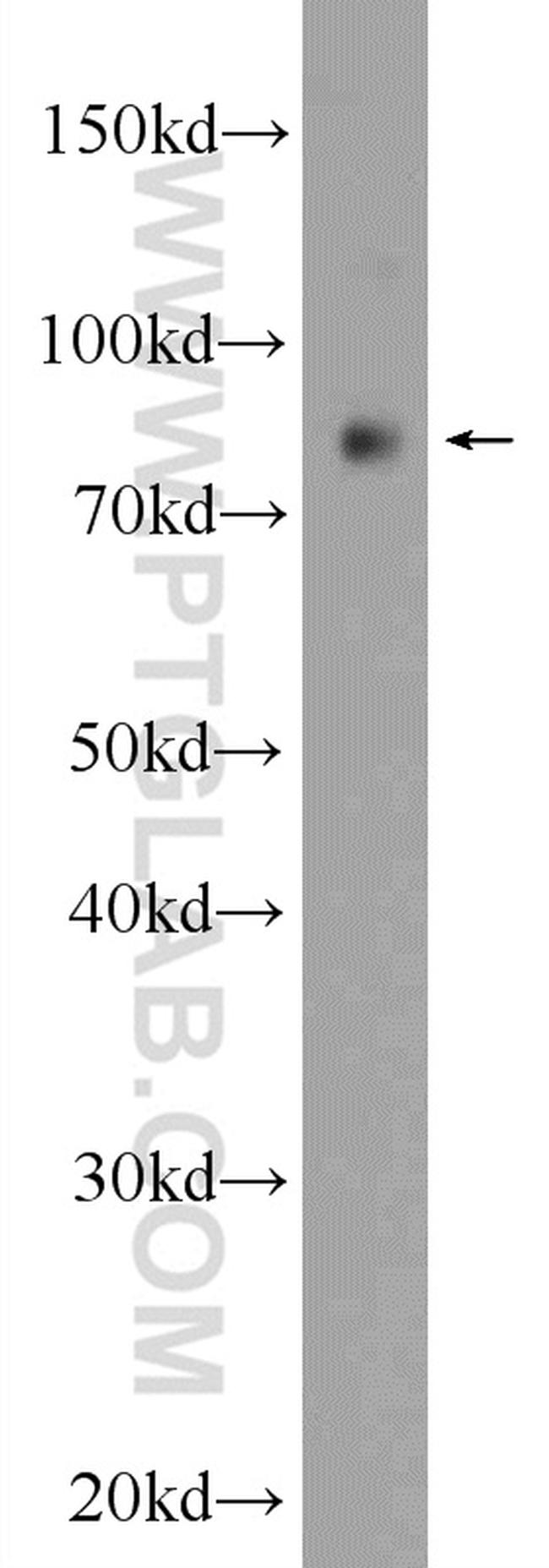 PPP1R3F Antibody in Western Blot (WB)