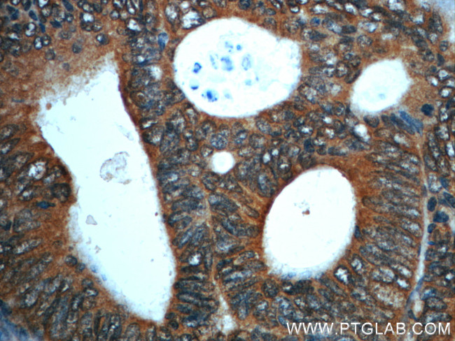 PKA C-alpha Antibody in Immunohistochemistry (Paraffin) (IHC (P))