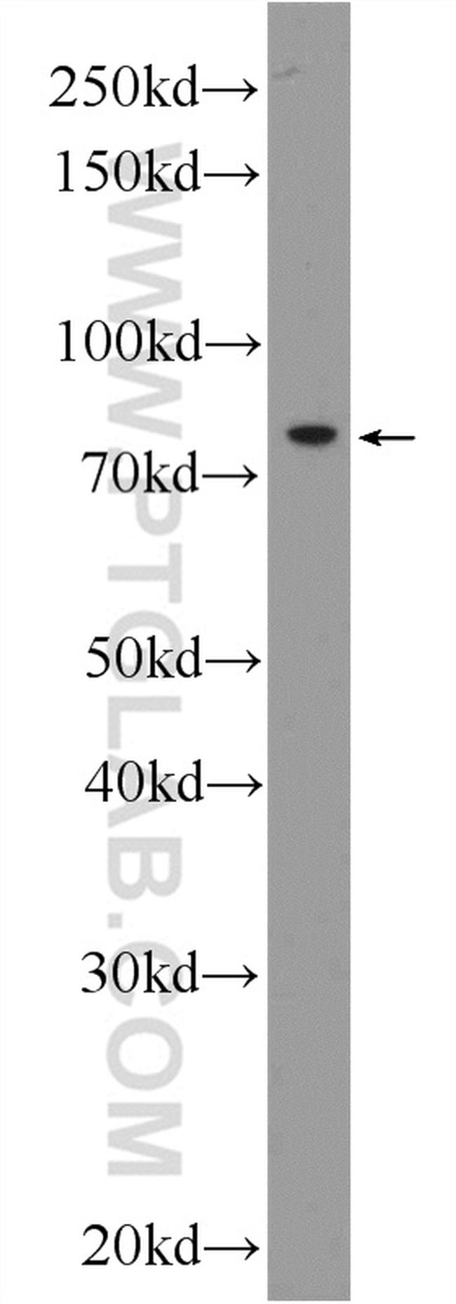 KLHL9 Antibody in Western Blot (WB)