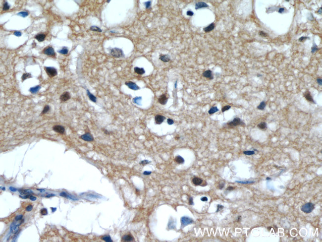 IMPDH2 Antibody in Immunohistochemistry (Paraffin) (IHC (P))