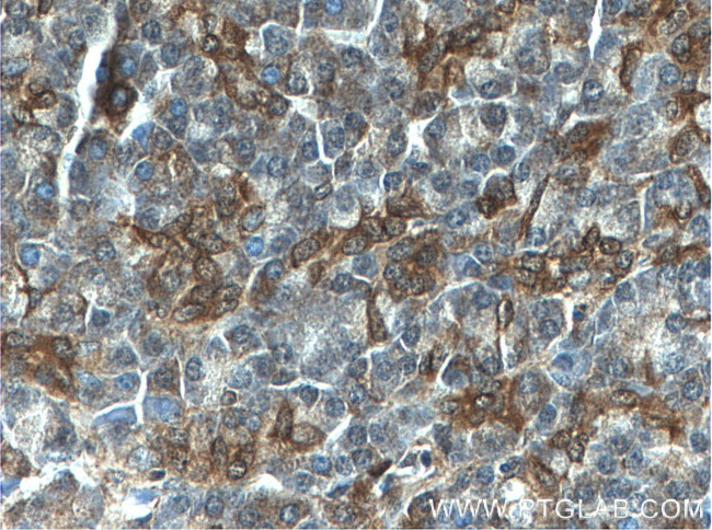 S3-12 Antibody in Immunohistochemistry (Paraffin) (IHC (P))
