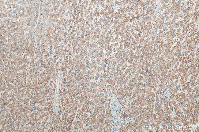 ND5 Antibody in Immunohistochemistry (Paraffin) (IHC (P))