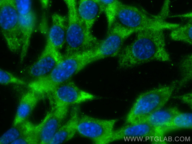 ZFYVE26 Antibody in Immunocytochemistry (ICC/IF)