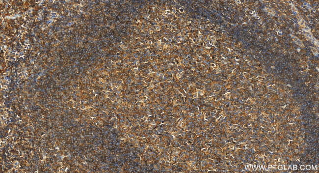 BMP6 Antibody in Immunohistochemistry (Paraffin) (IHC (P))