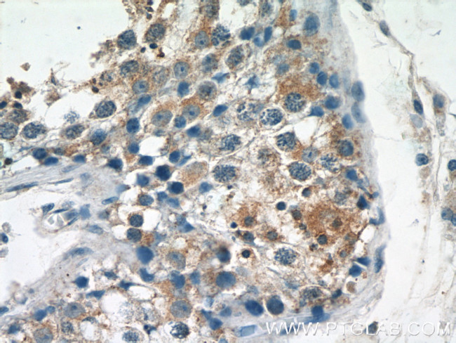 TSN Antibody in Immunohistochemistry (Paraffin) (IHC (P))