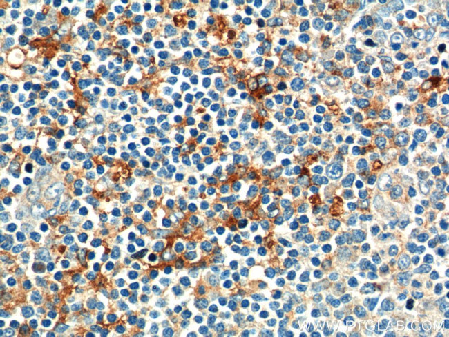 CD169 Antibody in Immunohistochemistry (Paraffin) (IHC (P))